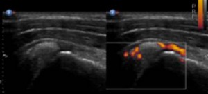 DIU d’échographie diagnostique ostéo-articulaire