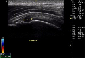 figure11