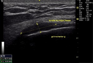 figure12