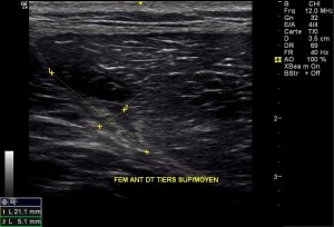 figure5