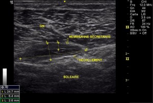 figure6